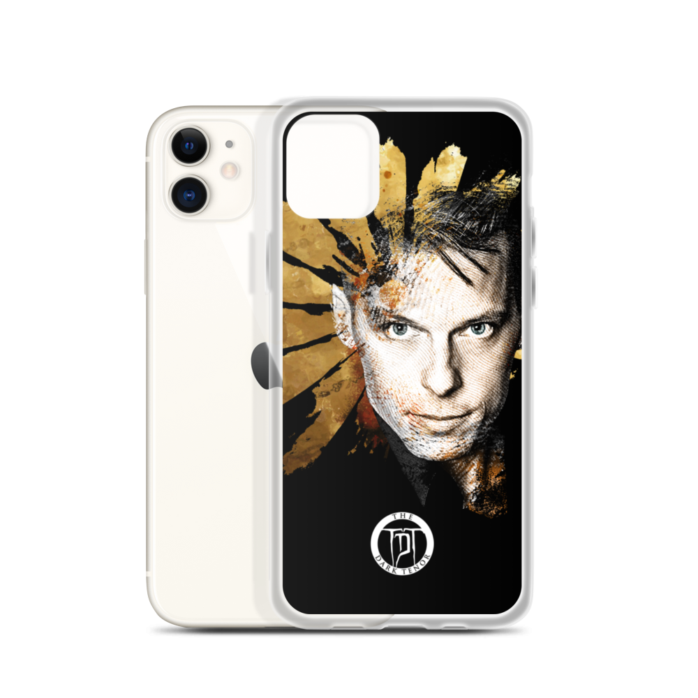 Apple iPhone telefon cover - Winter Lights, Pre-Tour Limited Gold Edition