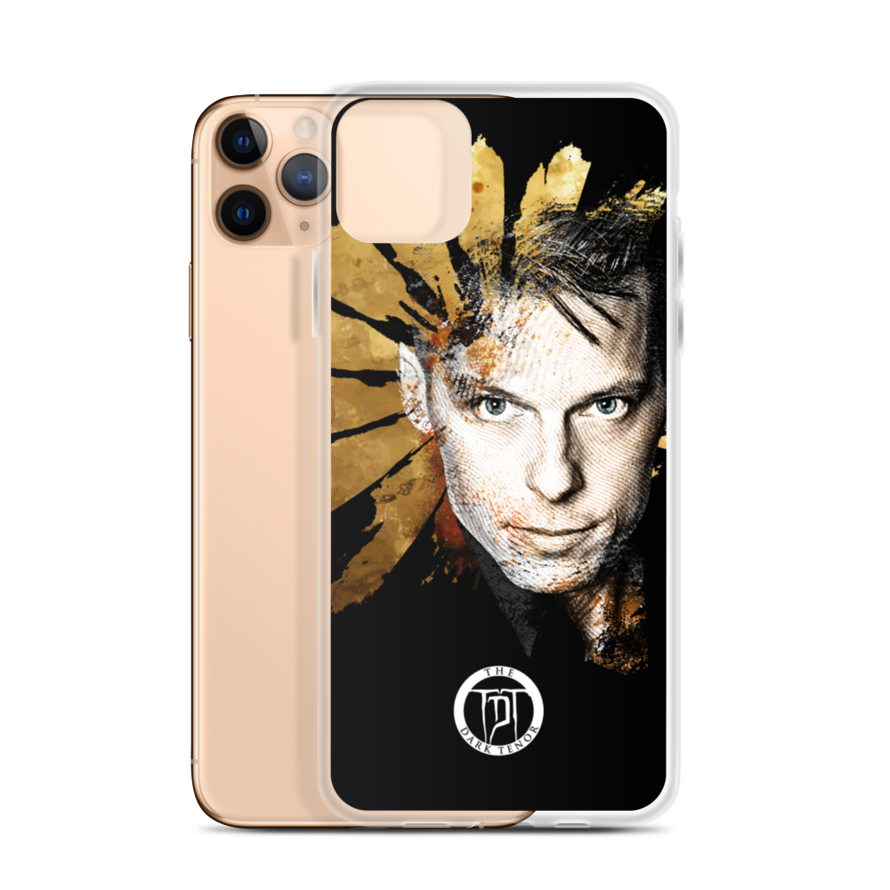 Apple iPhone Phone Case - Winter Lights, Pre-Tour Limited Gold Edition